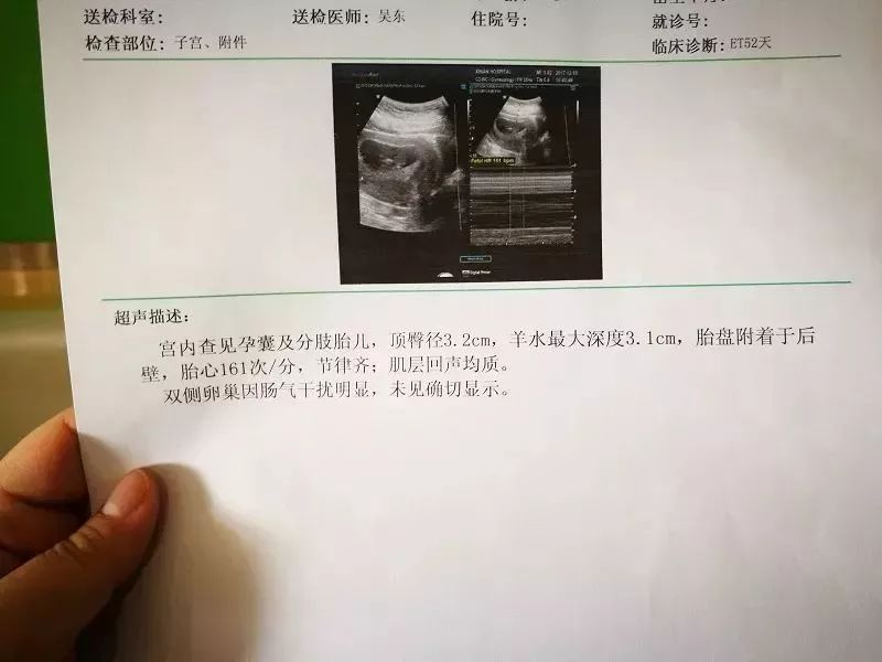2B一切顺利,3B顺利毕业,转去私立医院产科建卡时也告知了医生肚子里的宝宝是试管宝宝