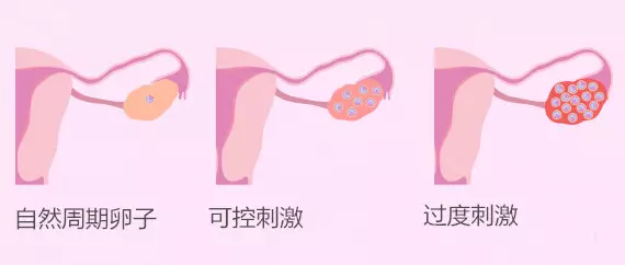 促排后有啥不良反应?