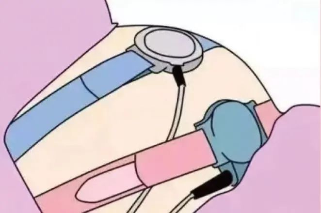 一般是从孕32周开始，孕32-36周期间，每两周做一次胎心监护。孕36周后每一周做一次胎心监护，针对高危孕妇可在医生建议下提前至孕26-28周，过预产期还没分娩，则需要每3天做一次，直至宝宝出生