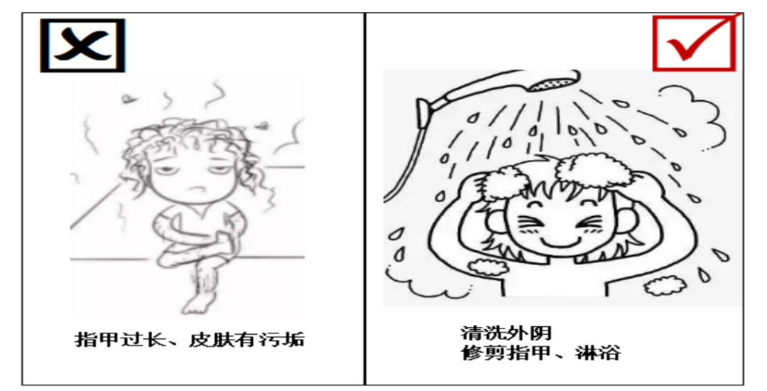 皮肤准备（术前一日）
